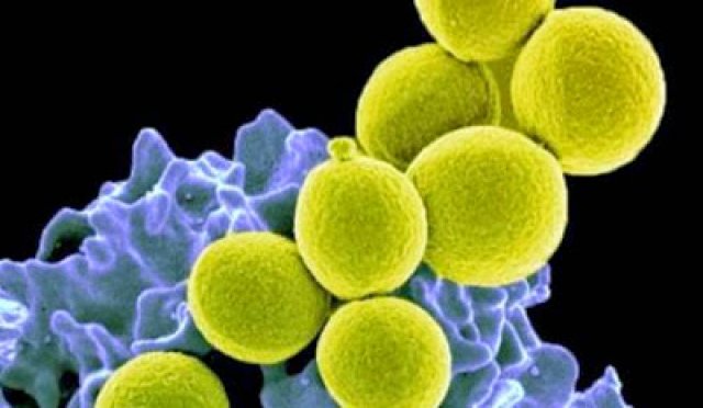 OMS alerta: O Mundo está caminhando para uma era Pós-Antibióticos