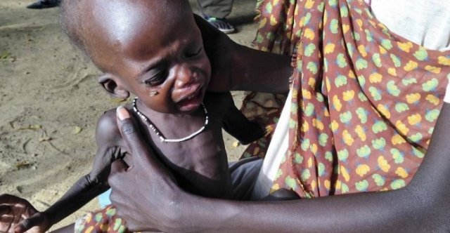Unicef pede socorro: 50 mil crianças no Sudão podem morrer de desnutrição